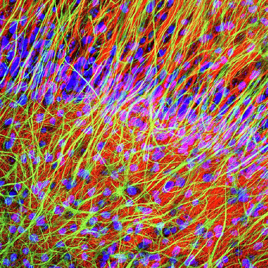 Brain Cells #9 Photograph by Dr. Chris Henstridge