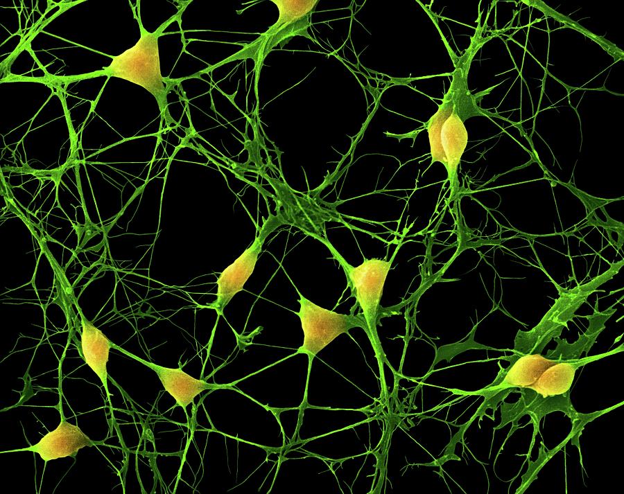 Cortical Neurons #9 Photograph by Dennis Kunkel Microscopy/science Photo Library