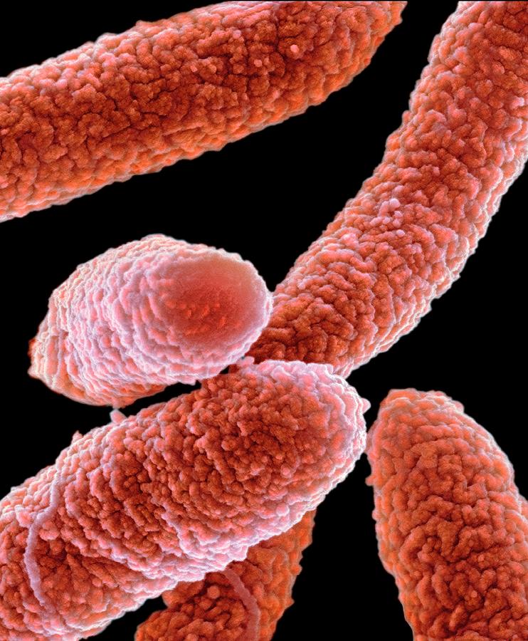 Escherichia Coli Photograph - E. Coli Bacteria #9 by Science Photo Library