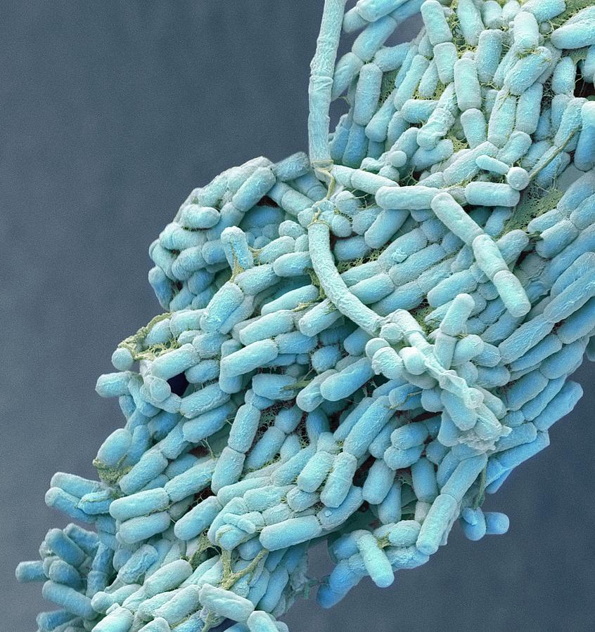 Escherichia Coli Photograph - E. Coli Bacteria #9 by Steve Gschmeissner
