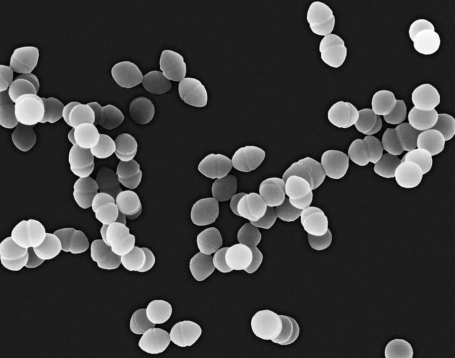 Enterococcus Faecium #9 Photograph by Dennis Kunkel Microscopy/science Photo Library