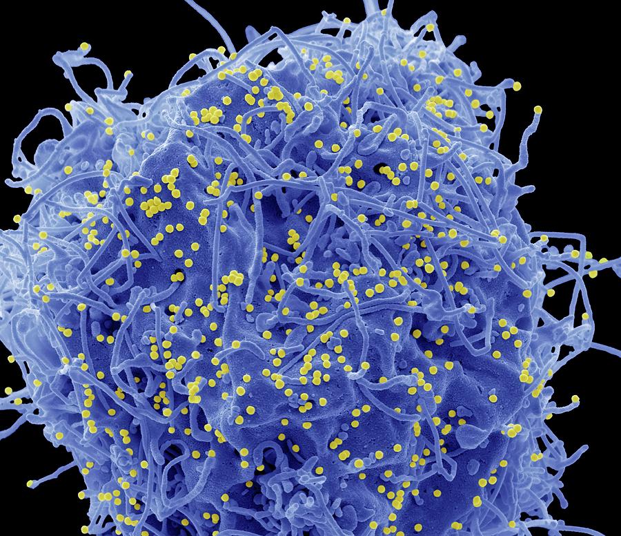 Hiv Infected Cell Photograph by Steve Gschmeissner/science Photo ...