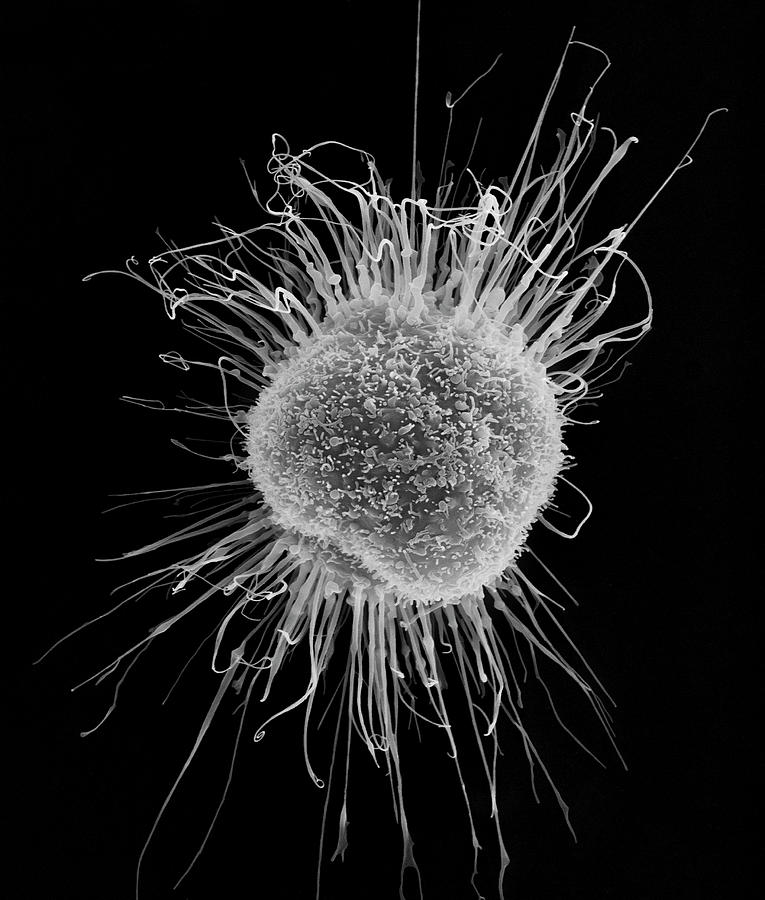Human Dendritic Cell #9 Photograph by Dennis Kunkel Microscopy/science Photo Library