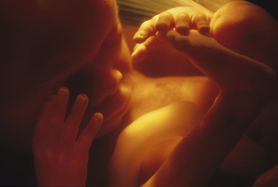 19 Weeks Photograph - Human foetus in the womb #9 by Science Photo Library