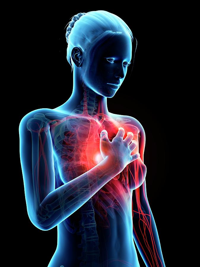 Illustration Photograph - Human Heart Attack #9 by Sebastian Kaulitzki
