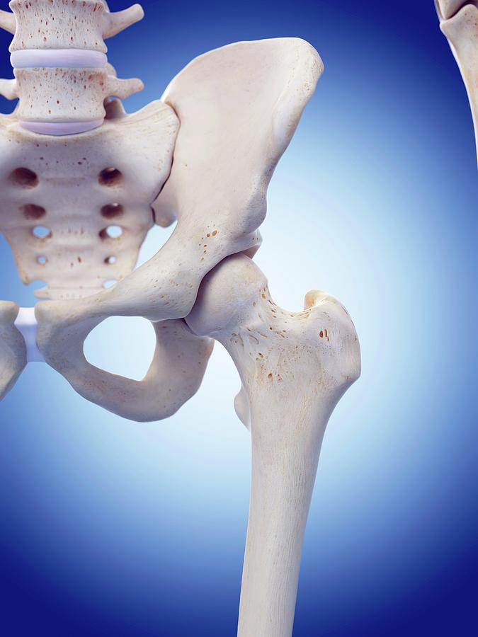 Human Hip Joint Photograph By Sebastian Kaulitzki Science Photo Library