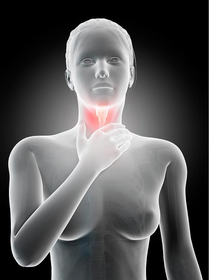 Illustration Photograph - Inflammation Of The Larynx #9 by Sebastian Kaulitzki