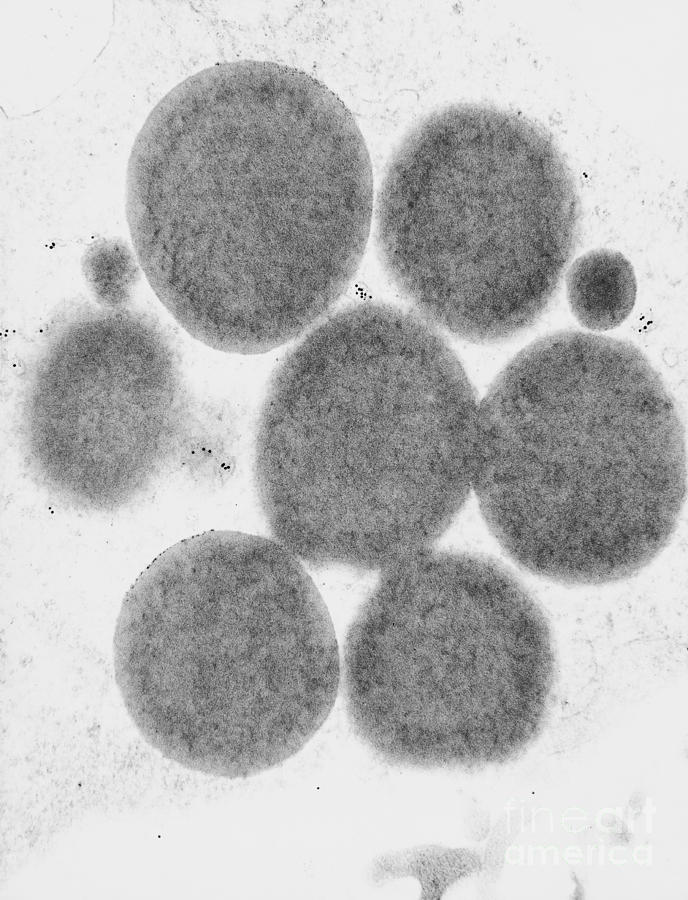 Lipid Droplets Tem #9 Photograph by David M. Phillips