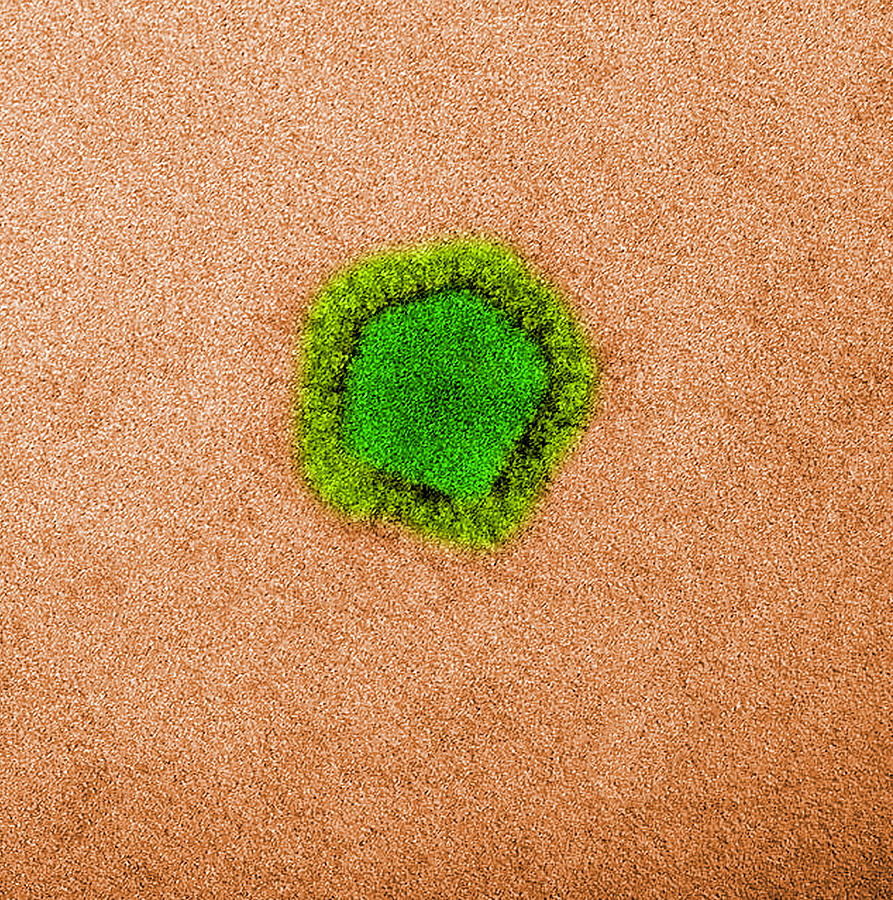 Mers-cov Middle East Respiratory #9 Photograph by Science Source