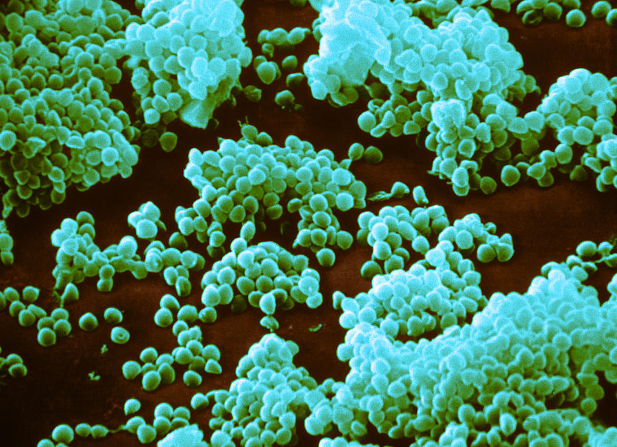 Micrococcus Agilis, Sem Photograph by Biology Pics - Fine Art America