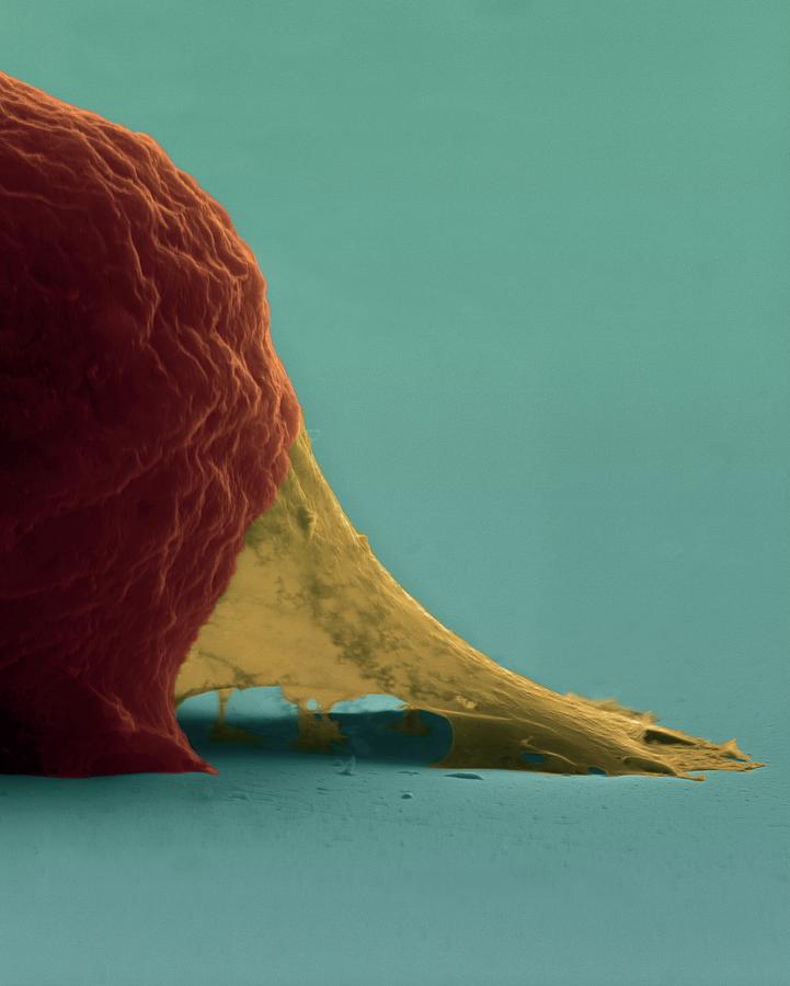 Muscle Myoblast Extracellular Matrix #9 Photograph by Dennis Kunkel Microscopy/science Photo Library
