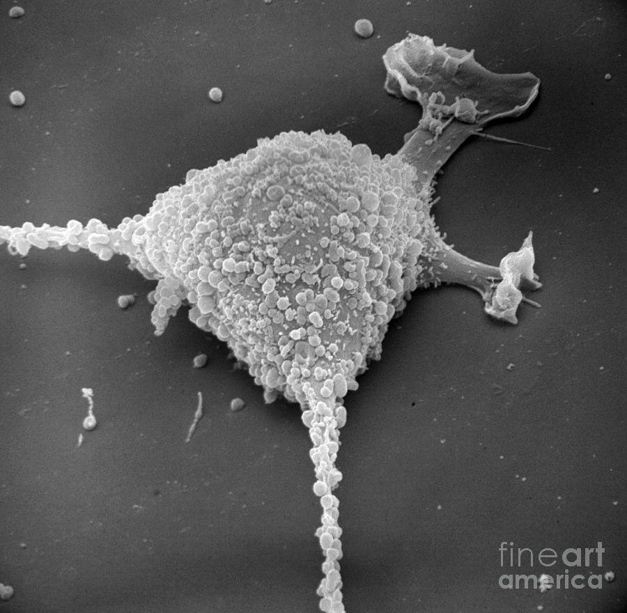 Mycoplasma Photograph - Mycoplasma #9 by David M. Phillips