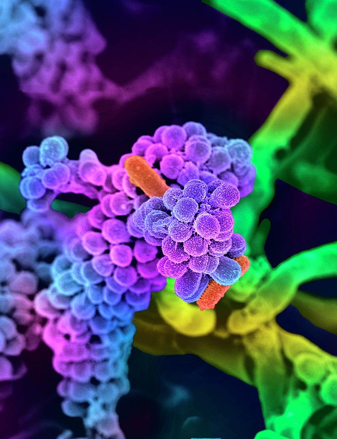 Oral Bacteria #9 Photograph by Science Photo Library