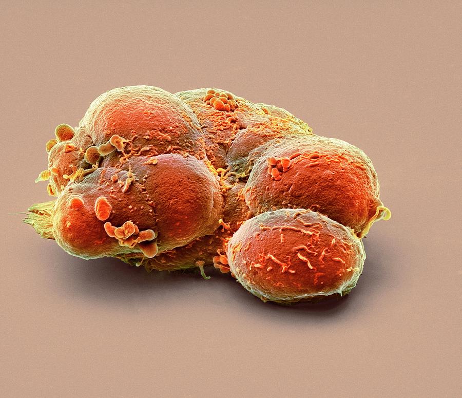 Pluripotent Stem Cells #9 Photograph by Steve Gschmeissner