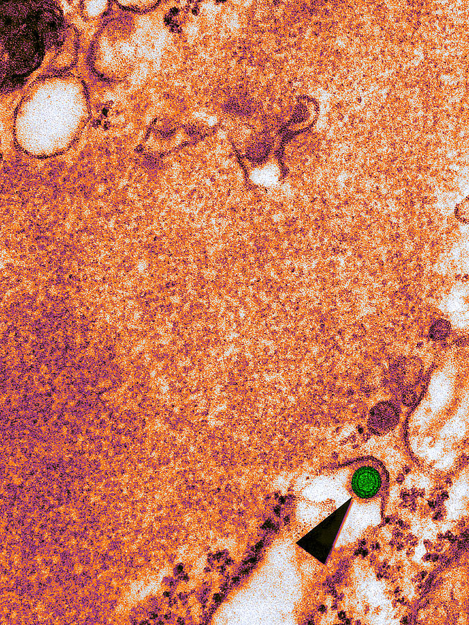 Science Photograph - Rabies Virus, Tem #9 by Science Source