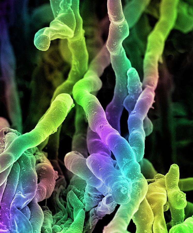 Streptomyces Coelicoflavus Bacteria Photograph by Science Photo Library ...