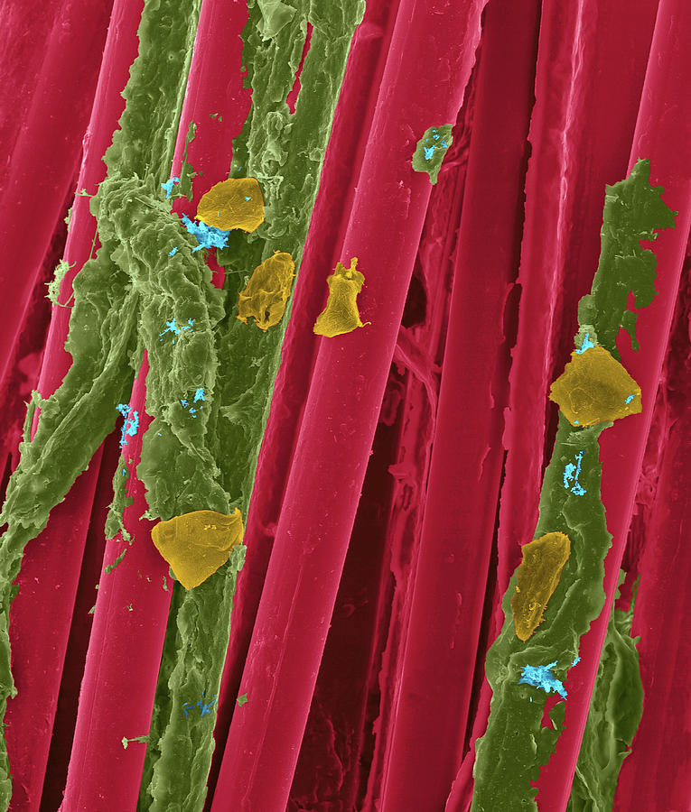 Used Wax Dental Floss #9 Photograph by Dennis Kunkel Microscopy/science Photo Library