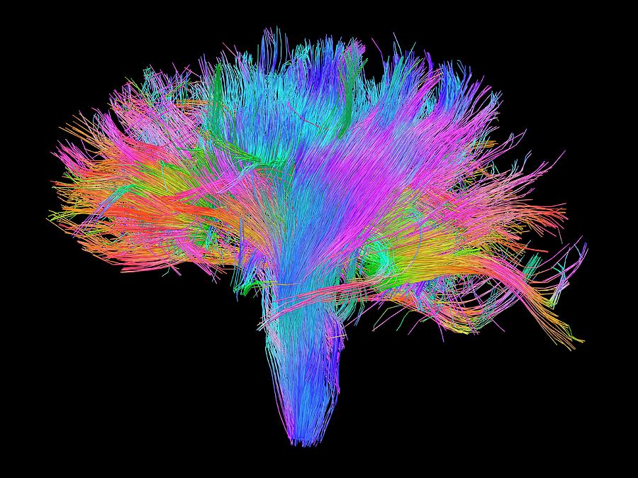 White Matter Fibres Of The Human Brain #9 Photograph by Alfred Pasieka/science Photo Library