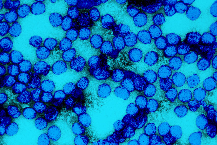 Yellow Fever Virus, Tem #9 Photograph by Science Source