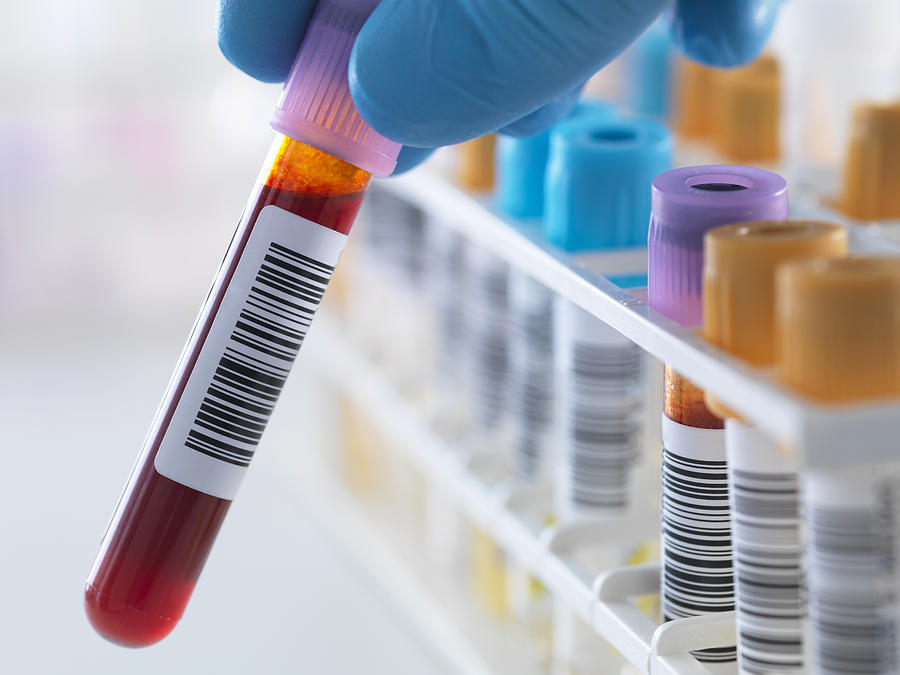A blood sample being held with a row of human samples for analytical testing including blood, urine, chemistry, proteins, anticoagulants and HIV in lab Photograph by Andrew Brookes