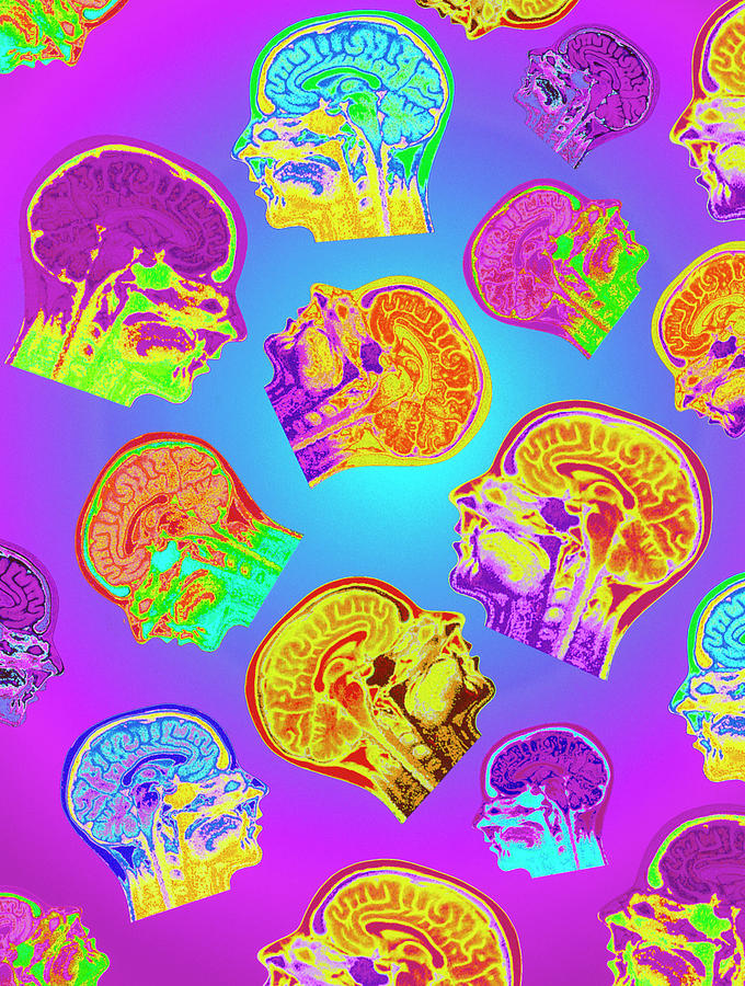 Abstract Coloured Mri Scans Of The Human Brain Photograph by Mehau Kulyk/science Photo Library