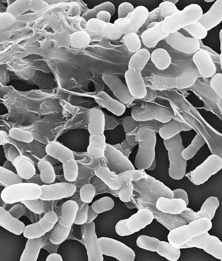 Acinetobacter Baumannii Photograph by Dennis Kunkel Microscopy/science Photo Library