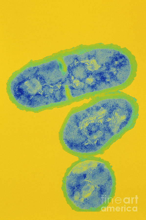 Acne Bacteria Photograph by Kwangshin Kim