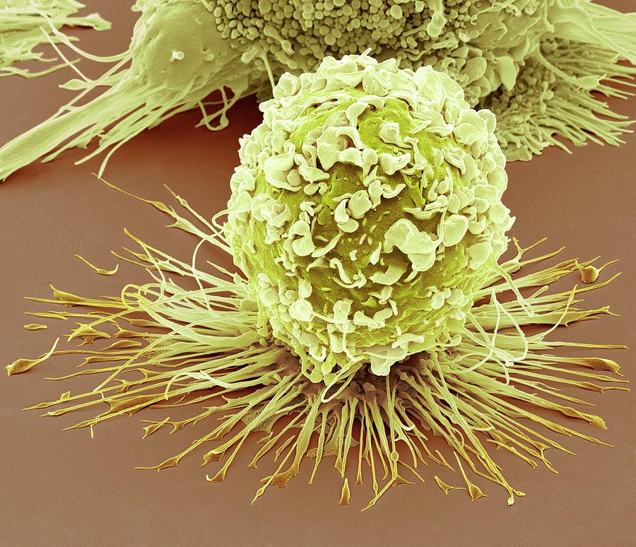 Activated Macrophage Photograph by Steve Gschmeissner