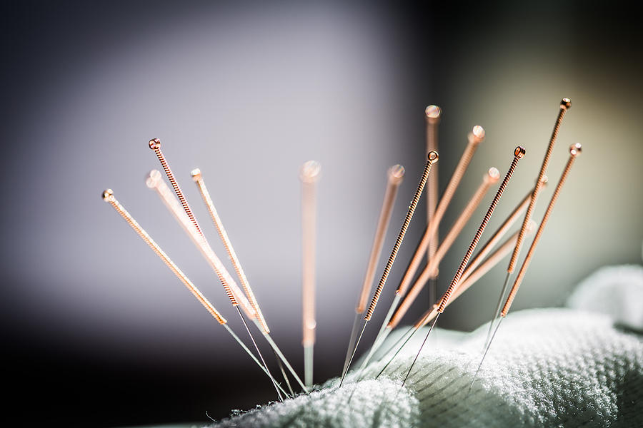 Acupuncture Needles Photograph by Philippe Garo