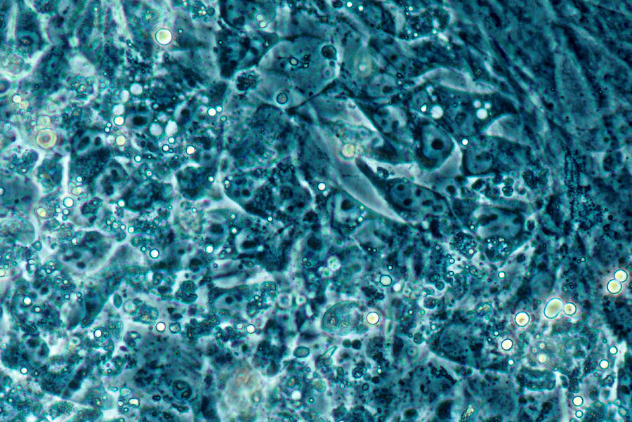 Acute Avian Leukemia Virus Photograph by Biology Pics