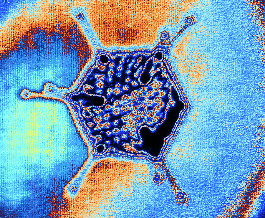 Adenovirus Photograph by Alfred Pasieka/science Photo Library