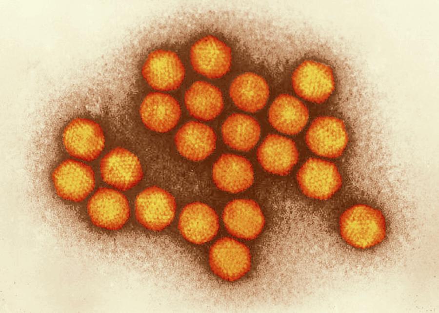 Adenovirus Particles Photograph by Ami Images/science Photo Library