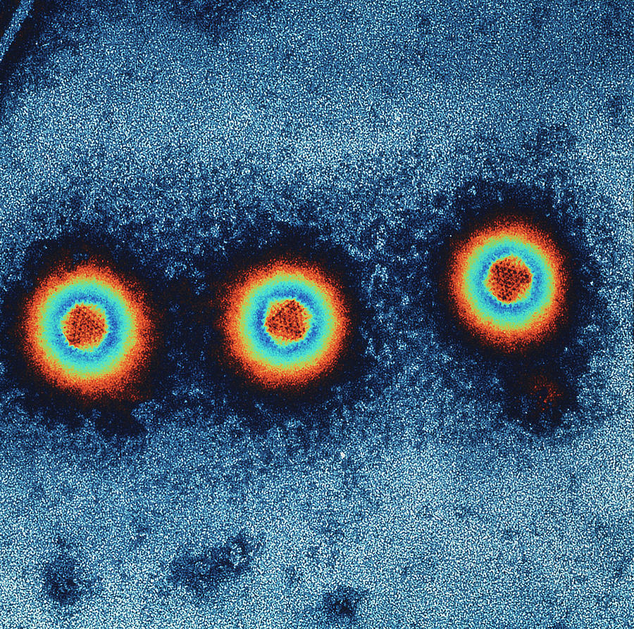 Adenoviruses Photograph by Mike Miller/science Photo Library