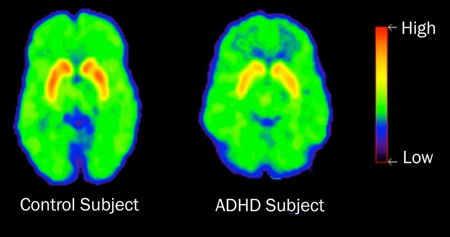 Adhd Levels Of Dopamine, Pet Photograph by Science Source