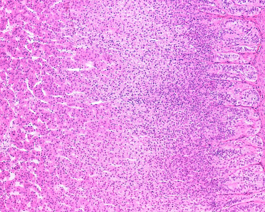 Adrenal Cortex Photograph - Adrenal Gland Cortex by Jose Calvo / Science Photo Library
