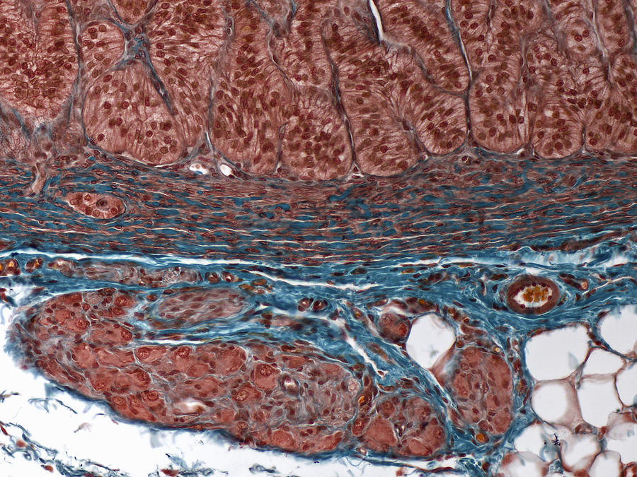Adrenal Gland, Periphery With Ganglion Photograph by Alvin Telser