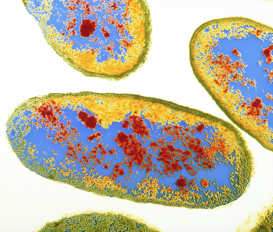 Bacteria Photograph - Aeromonas Hydrophila Bacteria by Dr Kari Lounatmaa/science Photo Library