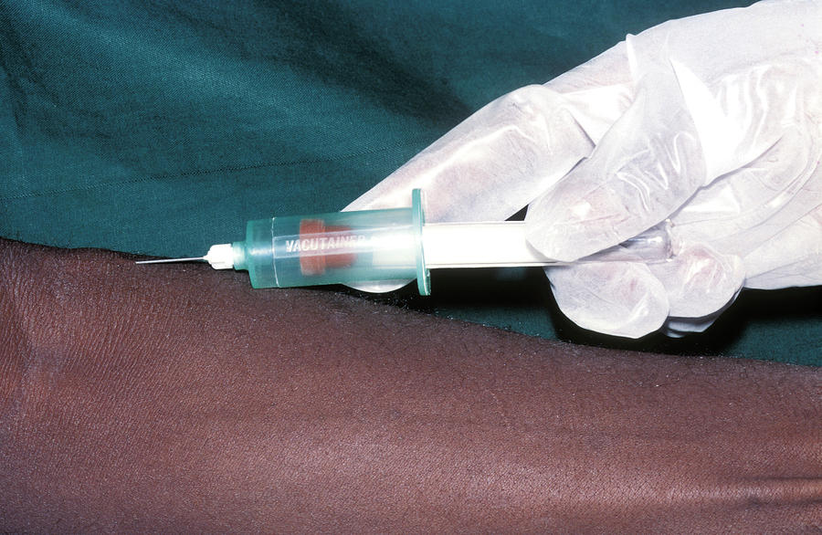 Aids Blood Sampling Photograph by Dr M.a. Ansary/science Photo Library