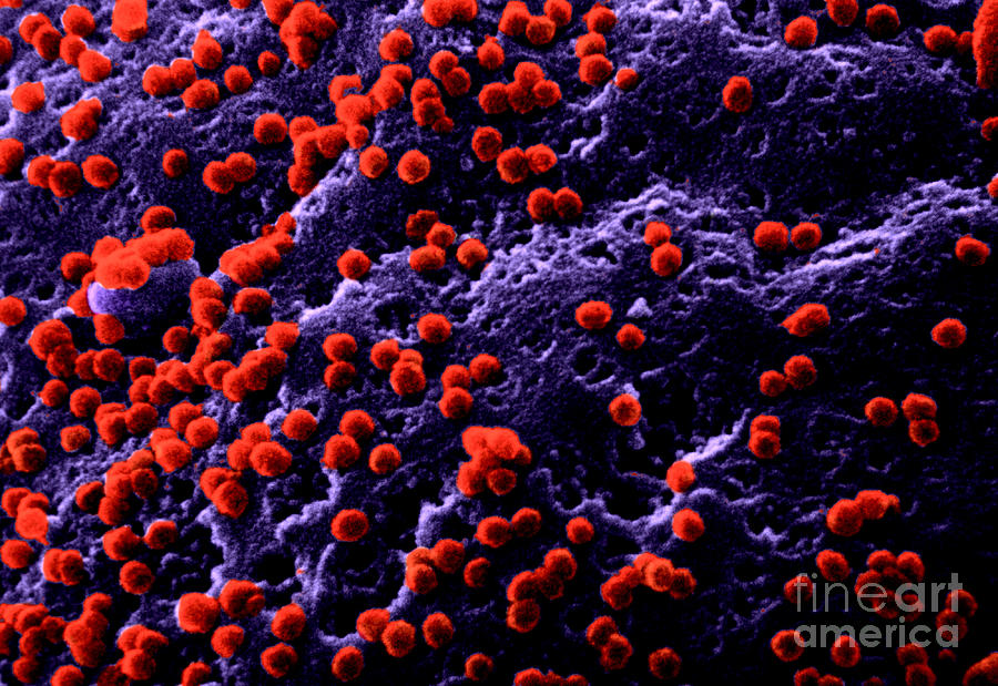 Aids Virus Photograph by Dr. Cecil H. Fox