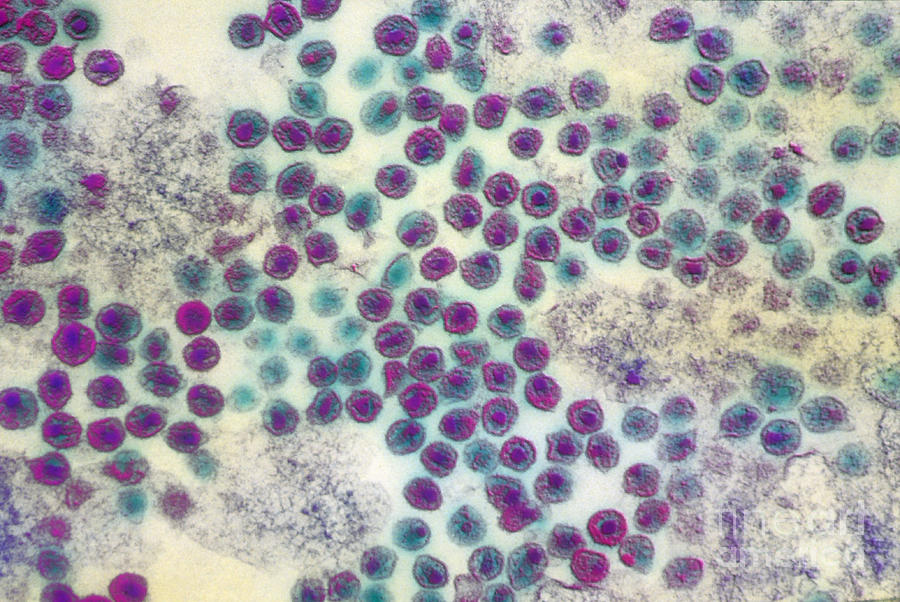 Medical Photograph - Aids Virus Tem by David M. Phillips