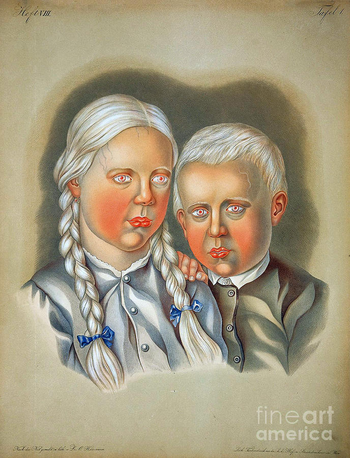 Albino Children 19th Century Photograph by Science Source