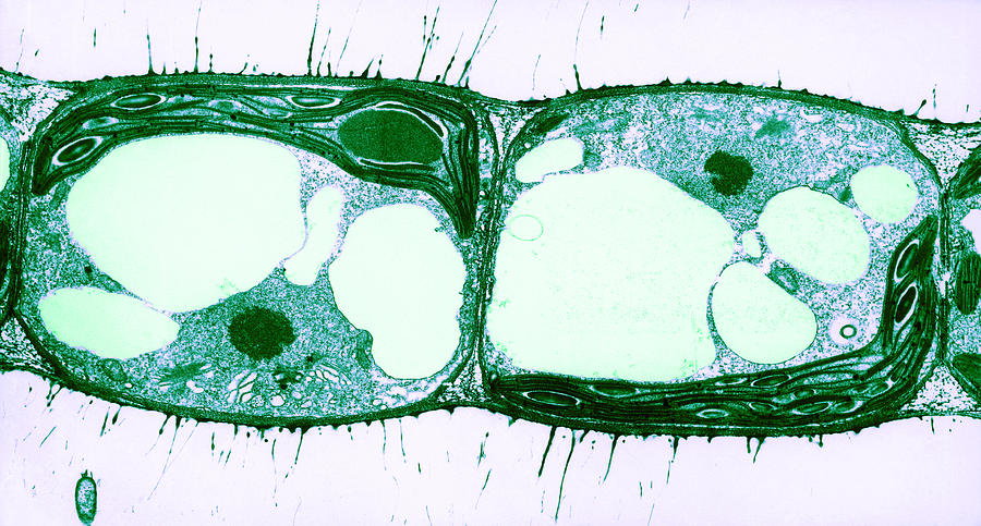Science Photograph - Algae Cell Division, Cylindrocapsa by Photo Researchers, Inc.
