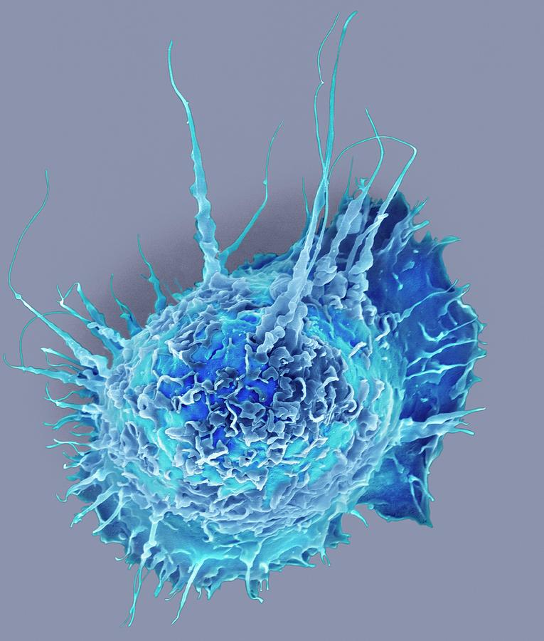 Macrophage Photograph - Alveolar Macrophage by Dennis Kunkel Microscopy/science Photo Library