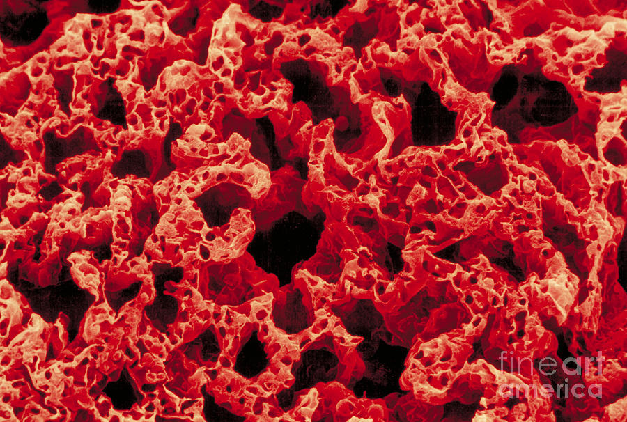 Alveoli In Lung Photograph by David M. Phillips