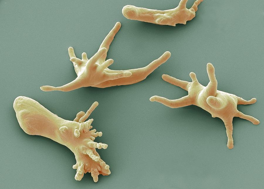 Animal Photograph - Amoeba protozoa, SEM by Science Photo Library