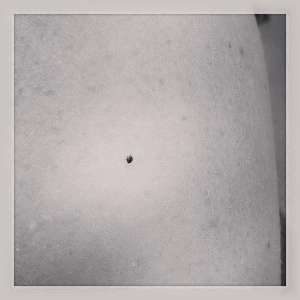 An Embedded Deer Tick- The Icing On The Photograph by Sarah Leonard