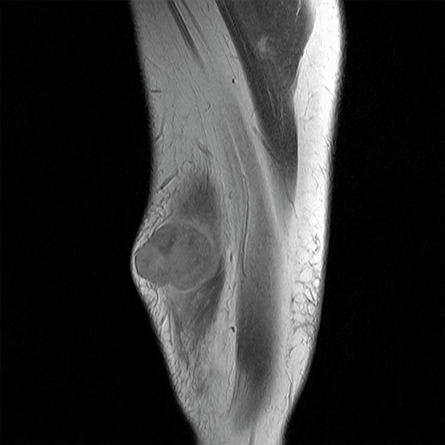 An Mri Of A Males  Thigh Photograph by Cultura Rf/photostock-israel