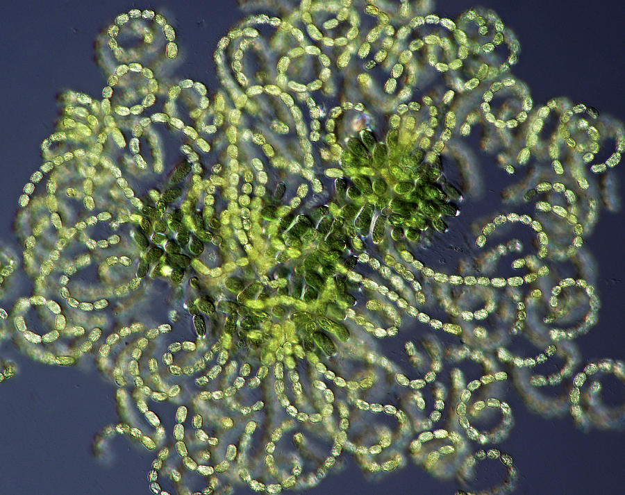 Nature Photograph - Anabaena Cyanobacteria by Marek Mis