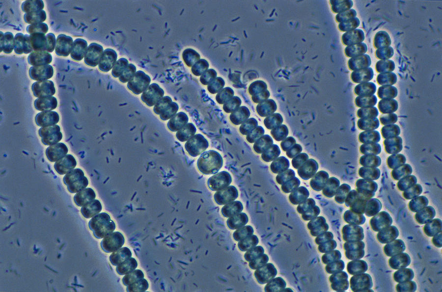 anabaena bacteria