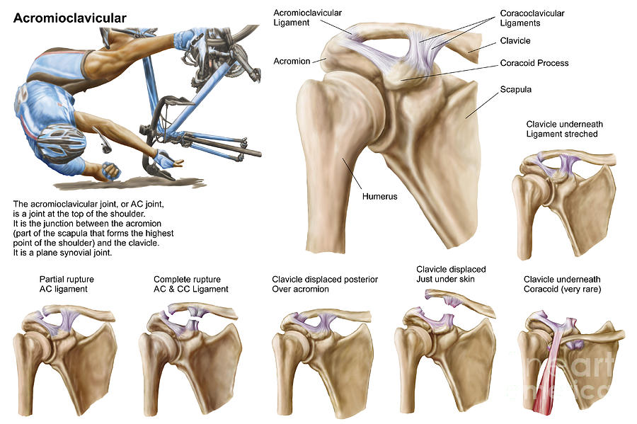 Bicycle Digital Art - Anatomy Of Acromioclavicular Joint by Stocktrek Images